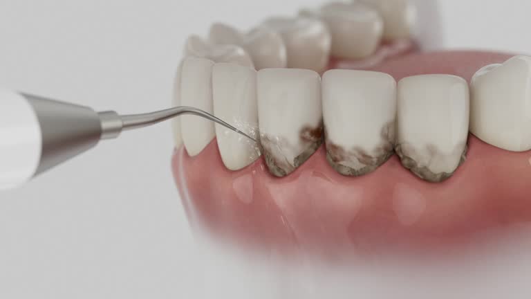 Reliable Emergency Dentist contractor in Templeton, CA by Smile Center Dentistry